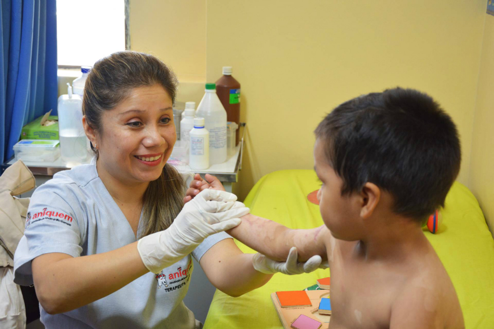 San Fernando colabora con Aniquem para la recuperación de niños quemados 1 paviferia san fernando 2019