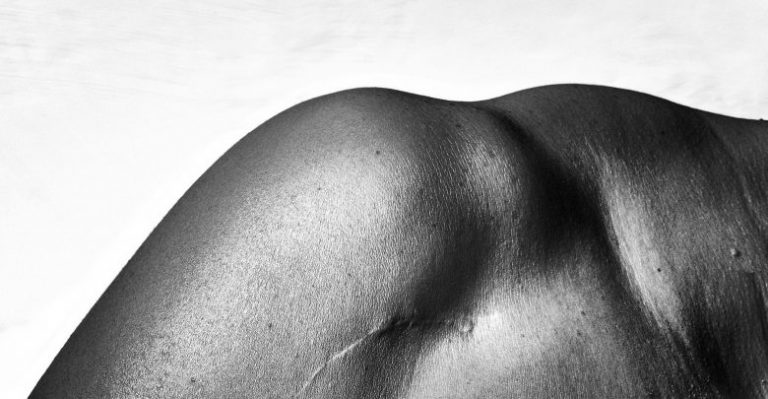 ‘Made in Adventure’, la acción que muestra cicatrices reales de deportistas 1 the north face campaña cicatrices