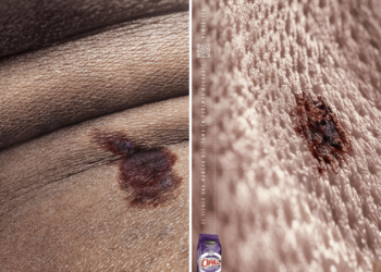 Opal: “No tenemos una fórmula para quitar este tipo de mancha”