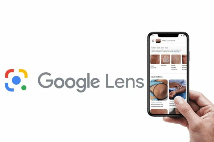 Así es como Google Lens identifica enfermedades de la piel usando IA