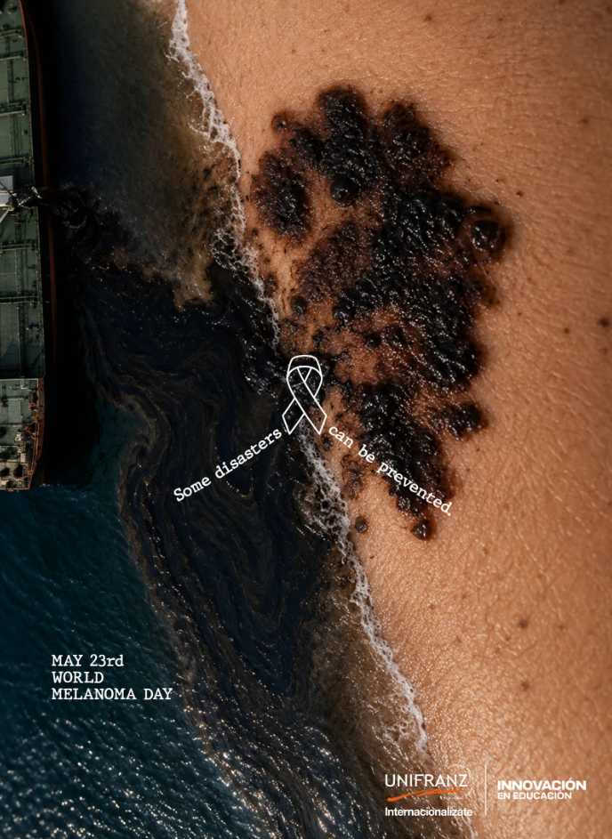 Campaña compara los melanomas con desastres naturales para promover la prevención del cáncer de piel 2 image 91