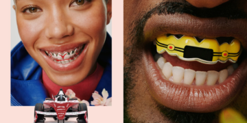 Nissan lanza colección de “grillz” inspirada en sus autos más legendarios 4 Nissan