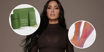 Kim Kardashian revela el suplemento que incorporó a su rutina para controlar la psoriasis 2 PORTADA MN 2026 08 13T162634.364