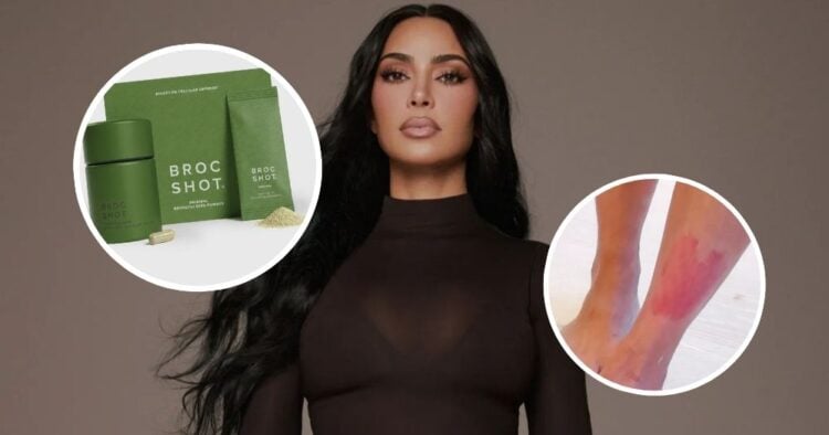 Kim Kardashian revela el suplemento que incorporó a su rutina para controlar la psoriasis 1 PORTADA MN 2026 08 13T162634.364